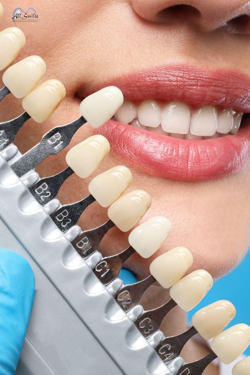Cosmetic Dentistry